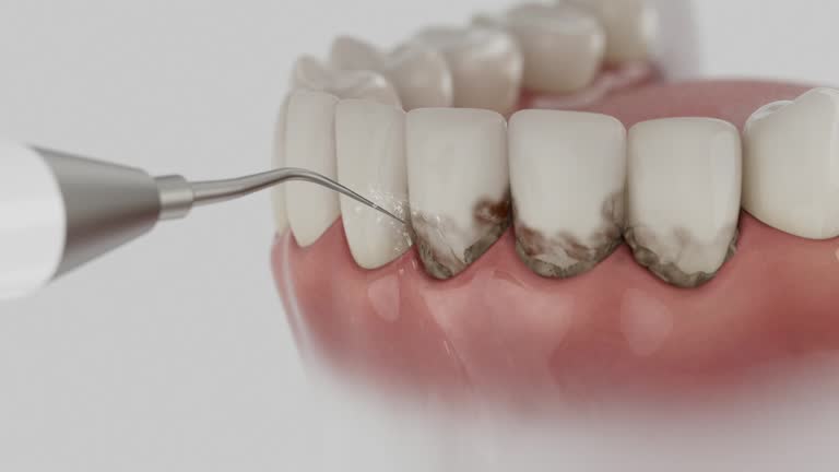 Trusted Teeth Cleaning And Checkup service in Chalfant, CA - Dentist Open Now